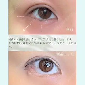 症例