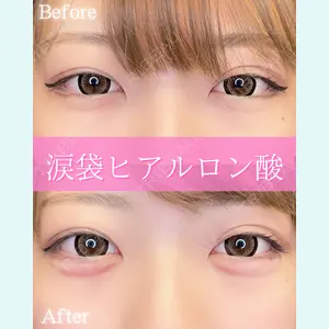 ルラ美容クリニック 大阪本院 平田 一記医師の症例