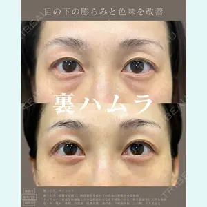 症例