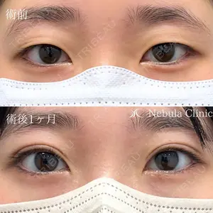 ネビュラクリニック 広島院 白岩 拓巳医師の症例