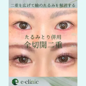 症例