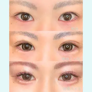 症例