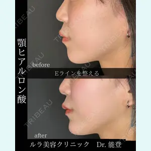 ルラ美容クリニック 札幌院 能登 貴弘医師の症例