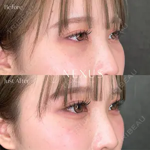 NEXUS CLINIC 岩井 勝矢医師の症例