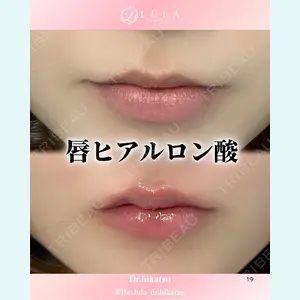 症例