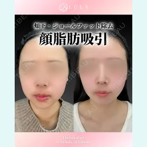 症例