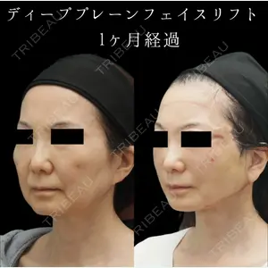 中尾 崇医師の症例