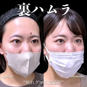 EMMO FACE CLINIC 大宮院 百瀬 直也医師の症例