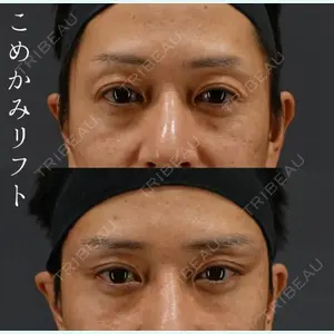 BIANCA銀座 中尾 崇医師の症例