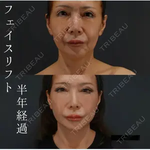 BIANCA銀座 中尾 崇医師の症例