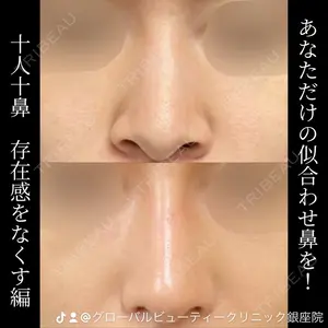 グローバルビューティークリニック 銀座院 理事長　杉崎　裕斗医師の症例