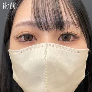 症例
