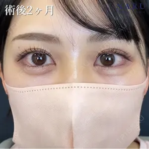 症例