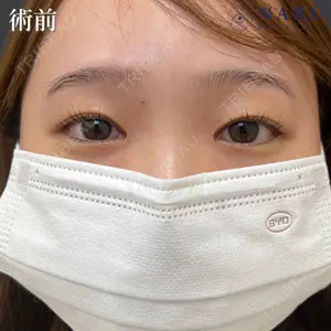 症例