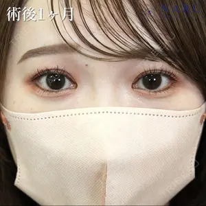 症例