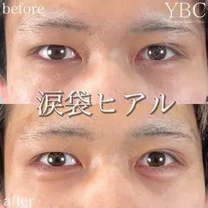 YBC横浜美容外科 立川院 大島 諒士医師の症例