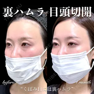 EMMO FACE CLINIC 大宮院 百瀬 直也医師の症例