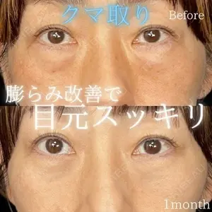 症例