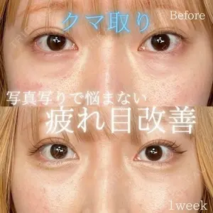 症例