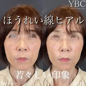 YBC横浜美容外科 立川院 大島 諒士医師の症例