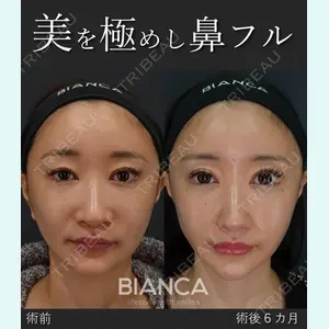 症例