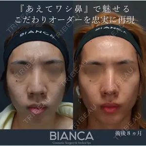 症例