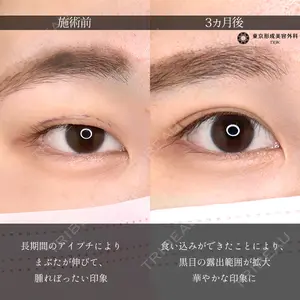 症例