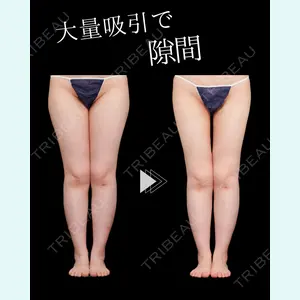 症例
