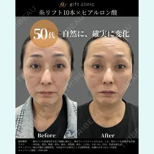 gift clinic 能登谷 翔医師の症例