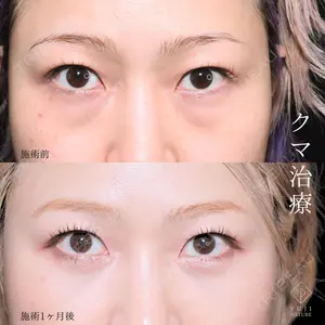 症例