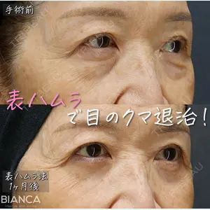 BIANCA表参道 大久保 由有医師の症例