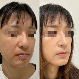 エターナル美容クリニック 久門田 詳医師の症例