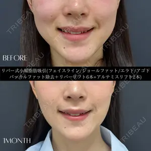 症例
