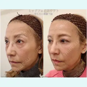 BIANCA銀座 魚谷 雄一朗医師の症例