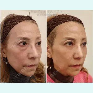 BIANCA銀座 魚谷 雄一朗医師の症例