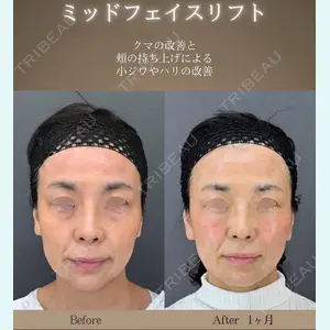 魚谷 雄一朗医師の症例