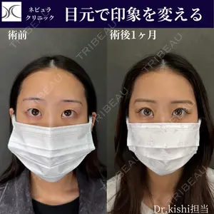 ネビュラクリニック 京都院 岸 大輔医師の症例