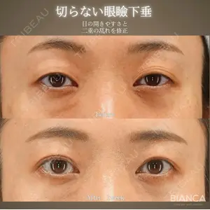 BIANCA銀座 魚谷 雄一朗医師の症例