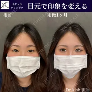 ネビュラクリニック 京都院 岸 大輔医師の症例