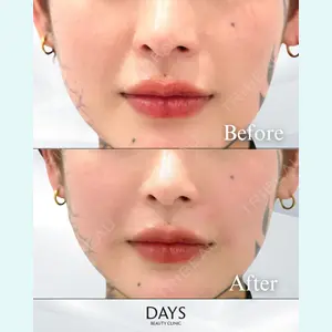 Days Beauty Clinic 本厚木院の症例