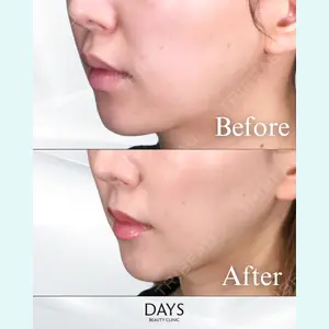 Days Beauty Clinic 本厚木院の症例