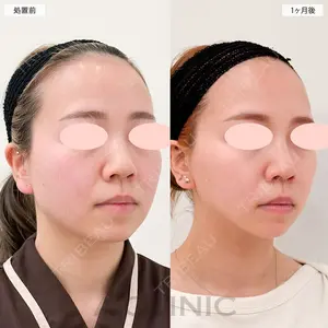 A CLINIC（エークリニック） 大阪院 田窪 賢志郎医師の症例