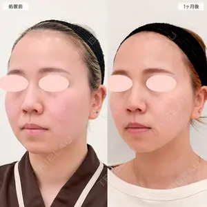 A CLINIC（エークリニック） 大阪院 田窪 賢志郎医師の症例