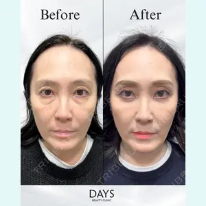 Days Beauty Clinic 本厚木院 比嘉 貴子医師の症例