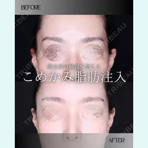 小倉美容外科/美容皮膚科 ビラビューティークリニック 大村 亞蘭医師の症例
