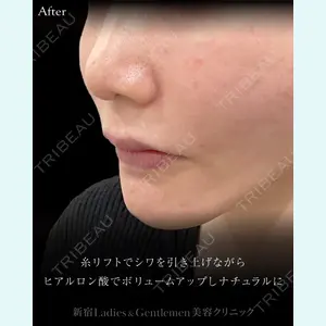 症例
