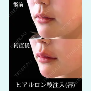 HAAB×DREAM BEAUTY CLINIC 東京本院 佐野 圭医師の症例