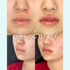 症例