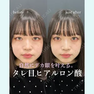 症例