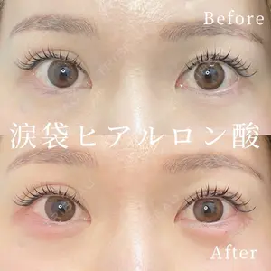 症例